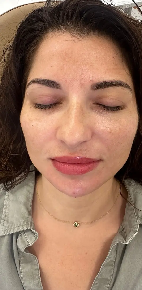 A relaxed woman with closed eyes, necklace, and light top after PRP Therapy at Refresh MedSpa.