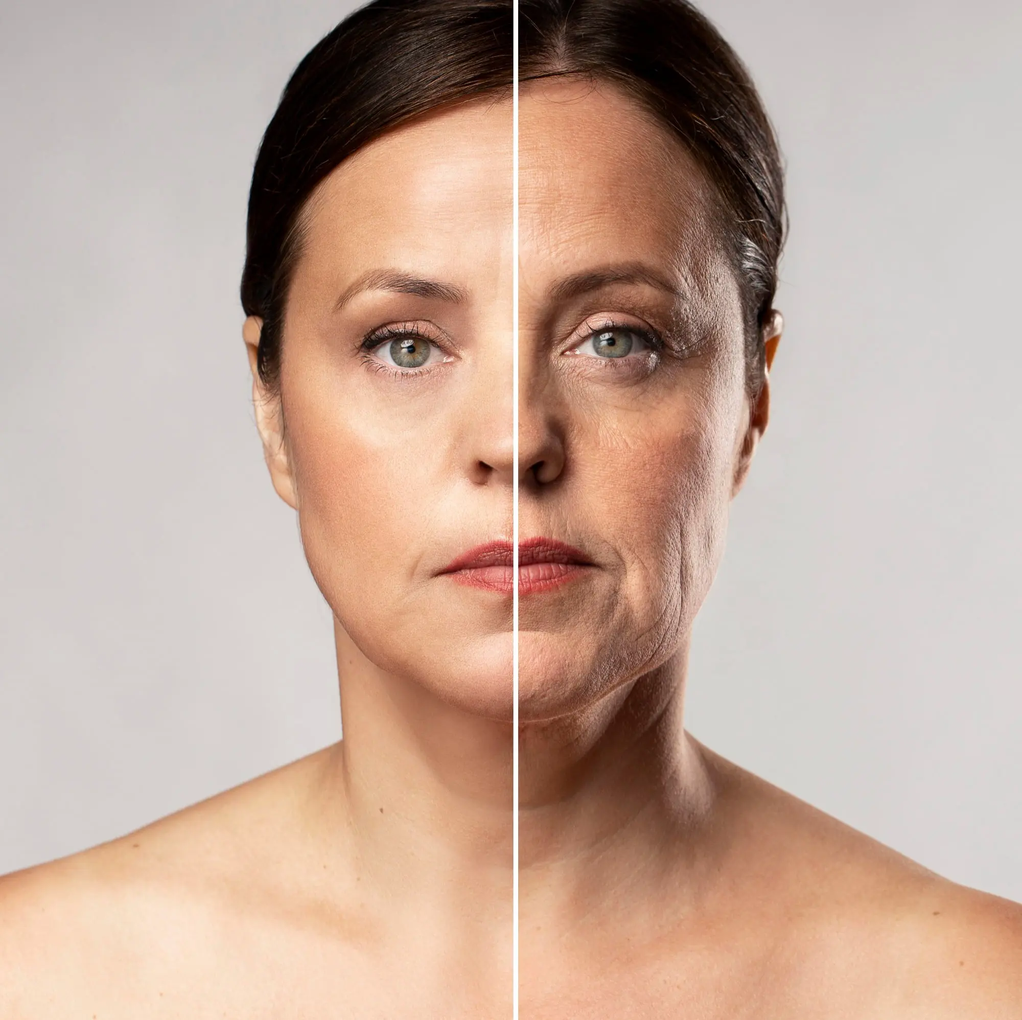A woman’s face divided in half displays youthful skin on the left and aged, wrinkled skin on the right, illustrating results you can achieve with Radiesse at Refresh MedSpa in Cape Coral, FL.